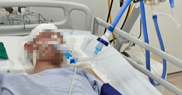 Thông tin mới nhất vụ nam sinh lớp 8 ở Hà Nội bị đánh chấn thương sọ não
