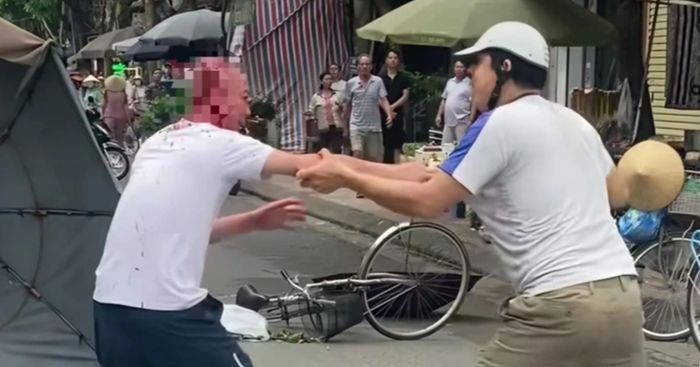 Người đàn ông ở Hà Nội bị đánh khiến đầu "nhuộm" đỏ máu