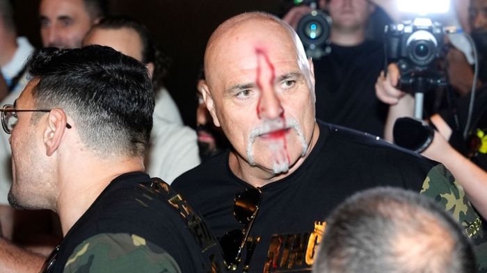 Bố Tyson Fury xô xát với Team Oleksandr Usyk tới chảy máu đầu